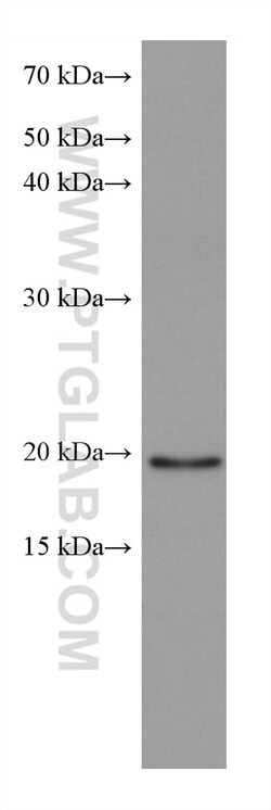 ARL8B Mouse Monoclonal Antibody, Proteintech Unconjugated; 150 &mu;L:Antibodies,
