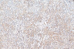 ARPC2 Mouse Monoclonal Antibody, Proteintech Unconjugated; 150 &mu;L:Antibodies,