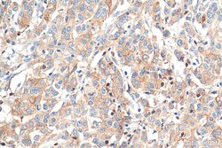 ARPC2 Mouse Monoclonal Antibody, Proteintech Unconjugated; 150 &mu;L:Antibodies,