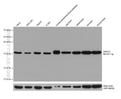 ARPC2 Mouse Monoclonal Antibody, Proteintech Unconjugated; 150 &mu;L:Antibodies,
