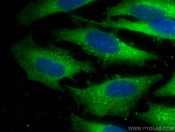 CoraLite Plus 488-conjugated ARPC2 Rabbit Polyclonal Antibody, Proteintech