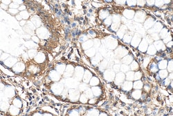 ACTRT3/ARPM1 Mouse Monoclonal Antibody, Proteintech Unconjugated; 20 &mu;L:Antibodies,