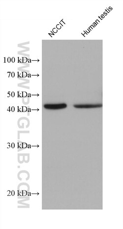 ACTRT3/ARPM1 Mouse Monoclonal Antibody, Proteintech Unconjugated; 20 &mu;L:Antibodies,