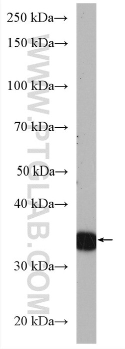 ASB1 Rabbit Polyclonal Antibody, Proteintech Unconjugated; 20 &mu;L:Antibodies,
