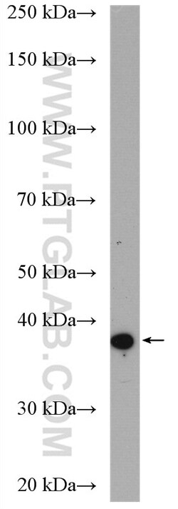 ASB1 Rabbit Polyclonal Antibody, Proteintech Unconjugated; 20 &mu;L:Antibodies,