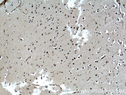 ASCL1 Rabbit Polyclonal Antibody, Proteintech:Antibodies:Primary Antibodies