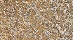 ASCL2 Rabbit Polyclonal Antibody, Proteintech Unconjugated; 20 &mu;L:Antibodies,
