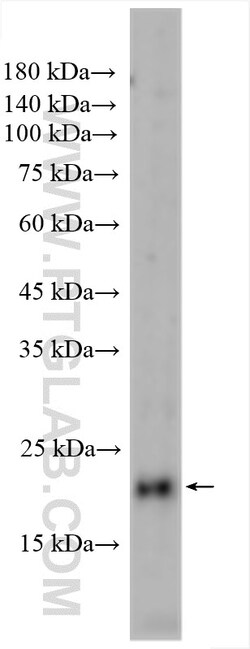 ASCL2 Rabbit Polyclonal Antibody, Proteintech Unconjugated; 20 &mu;L:Antibodies,