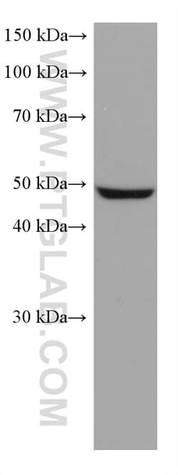 ASL Mouse Monoclonal Antibody, Proteintech Unconjugated; 150 &mu;L:Antibodies,