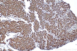 ATAD4 / PRR15L Rabbit Polyclonal Antibody, Proteintech Unconjugated; 150
