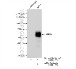 ATF4 Rabbit Recombinant Antibody, Proteintech Unconjugated; 20 &mu;L:Antikörper