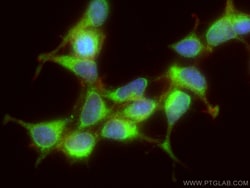 ATG16L1 Rabbit Polyclonal Antibody, Proteintech:Anticuerpos:Anticuerpos