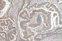 ATG16L1 Rabbit Polyclonal Antibody, Proteintech:Anticuerpos:Anticuerpos