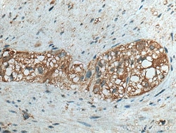 ATG4B Mouse Monoclonal Antibody, Proteintech Unconjugated; 150 &mu;L:Anticorps,