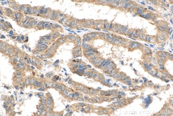ATG5 Rabbit Recombinant Antibody, Proteintech:Antibodies:Primary Antibodies