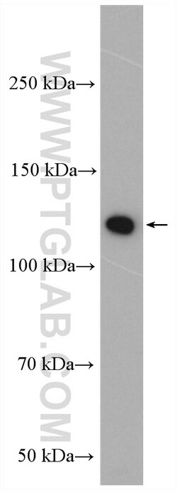 PARK9/ATP13A2 Rabbit Polyclonal Antibody, Proteintech Unconjugated; 20