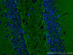 ATP1A3 Rabbit Polyclonal Antibody, Proteintech Unconjugated; 20 &mu;L:Antibodies,