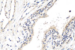ATP1A3 Rabbit Polyclonal Antibody, Proteintech Unconjugated; 20 &mu;L:Antibodies,