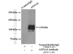 ATP1A3 Rabbit Polyclonal Antibody, Proteintech Unconjugated; 20 &mu;L:Antibodies,