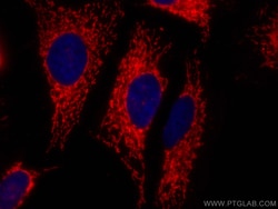 ATP5A1 Rabbit Recombinant Antibody, Proteintech Unconjugated; 100 &mu;L:Antibodies,