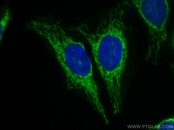 ATP5A1 Rabbit Recombinant Antibody, Proteintech Unconjugated; 100 &mu;L:Antibodies,