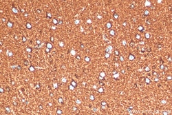 ATP5A1 Rabbit Recombinant Antibody, Proteintech Unconjugated; 100 &mu;L:Antibodies,