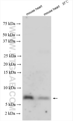 ATP5E Rabbit Polyclonal Antibody, Proteintech Unconjugated; 150 &mu;L:Antibodies,