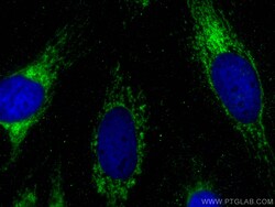 ATP5F1 Mouse Monoclonal Antibody, Proteintech Unconjugated; 150 &mu;L:Antibodies,