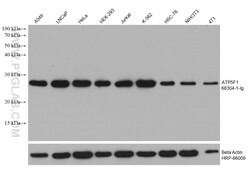 ATP5F1 Mouse Monoclonal Antibody, Proteintech Unconjugated; 150 &mu;L:Antibodies,