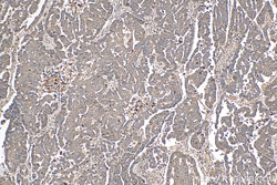 ATP5G3 Rabbit Polyclonal Antibody, Proteintech:Antibodies:Primary Antibodies
