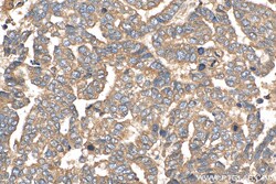ATP5G3 Rabbit Polyclonal Antibody, Proteintech:Antibodies:Primary Antibodies