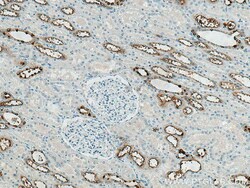 ATP6V0A4 Rabbit Polyclonal Antibody, Proteintech:Antibodies:Primary Antibodies
