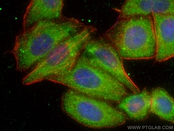 ATP6V1H Mouse Monoclonal Antibody, Proteintech:Antibodies:Primary Antibodies