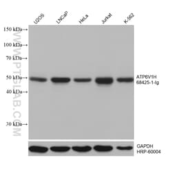 ATP6V1H Mouse Monoclonal Antibody, Proteintech:Antibodies:Primary Antibodies