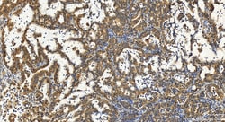ATPAF2 Rabbit Polyclonal Antibody, Proteintech Unconjugated; 150 &mu;L:Antibodies,