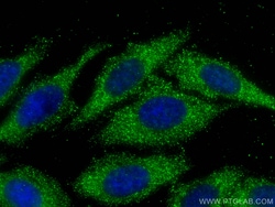 ATPAF2 Mouse Monoclonal Antibody, Proteintech:Antibodies:Primary Antibodies