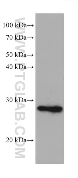 ATPBD4 Mouse Monoclonal Antibody, Proteintech Unconjugated; 150 &mu;L:Antibodies,