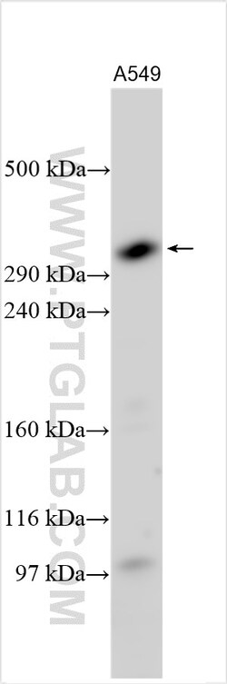 ATRX Rabbit Polyclonal Antibody, Proteintech Unconjugated; 20 &mu;L:Antibodies,