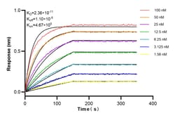 Band 3/AE 1 Rabbit Recombinant Antibody, Proteintech:Antibodies:Primary