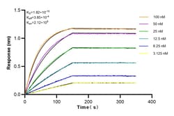KGA/GAC Rabbit Recombinant Antibody, Proteintech:Antibodies:Primary Antibodies