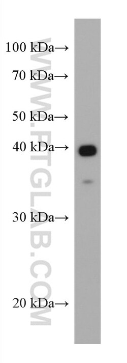 AgBR1 Mouse Monoclonal Antibody, Proteintech:Antistoffer:Primære antistoffer