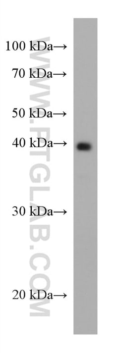 AgBR1 Mouse Monoclonal Antibody, Proteintech