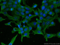 AlaRS Mouse Monoclonal Antibody, Proteintech Unconjugated; 20 &mu;L:Anticorps,