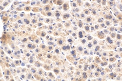 Alpha-2-antiplasmin Rabbit Polyclonal Antibody, Proteintech 20 &mu;L | Buy Online | Proteintech | Fisher Scientific