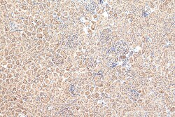Angptl4 Rabbit Polyclonal Antibody, Proteintech Unconjugated; 20 &mu;L:Antibodies