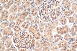 Angptl4 Rabbit Polyclonal Antibody, Proteintech Unconjugated; 20 &mu;L:Antibodies