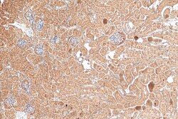 Angptl4 Rabbit Polyclonal Antibody, Proteintech Unconjugated; 20 &mu;L:Antibodies