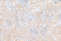 Angptl4 Rabbit Polyclonal Antibody, Proteintech Unconjugated; 20 &mu;L:Antibodies