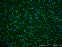 Ataxin 2 Mouse Monoclonal Antibody, Proteintech Unconjugated; 150 &mu;L:Antibodies,