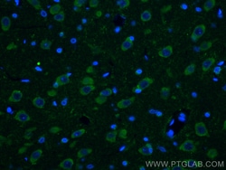 Ataxin 2 Mouse Monoclonal Antibody, Proteintech Unconjugated; 150 &mu;L:Antibodies,